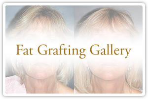 Fat Grafting Gallery