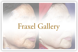 Fraxel Gallery