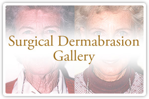 Surgical Dermabrasion Gallery